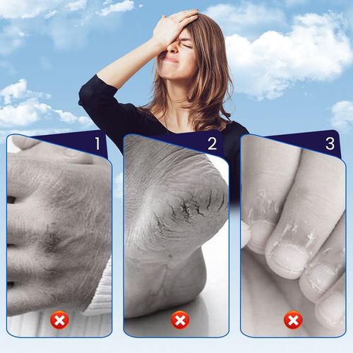 Restorative Patches for Cracked Skin