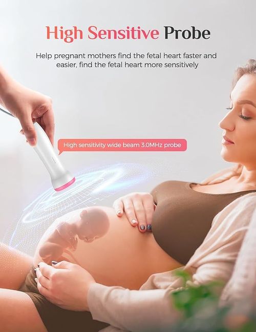 Fetal Doppler monitor