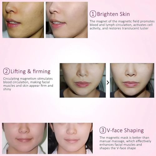 Ice Face Mask with Acupoint Magnets