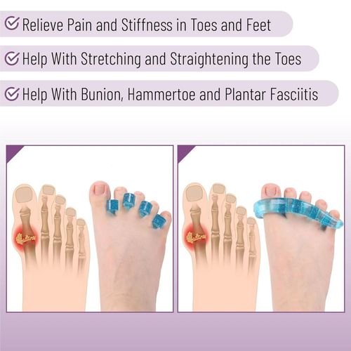 (2 Pair, Blue) Silicone Toe Separators – Bunion Relief Toe Spacers for Foot Pain Comfort