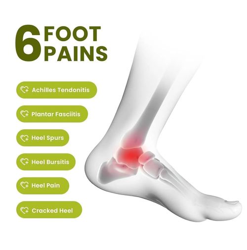 Adjustable Silicone Heel Protectors