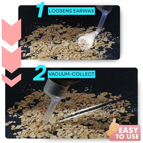 Earwax Vacuum