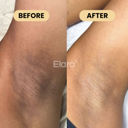 24-Hour Aluminum-Free Deodorant