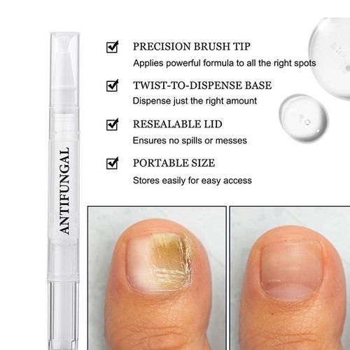 Nail fungus treatment pen for damaged nails