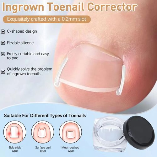 Professional Ingrown Toenail Set with Breathable Ingrown Toenail Strips, Curved Toenails Corrector Patch, Painless File and Lifter Pedicure Tools for Women Man Nail File Lifter Pedicure Tools