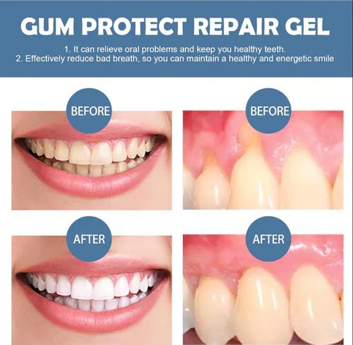 Gum Protection Repair Gel