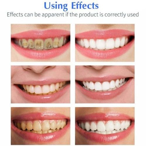 Teeth Whitening Pen