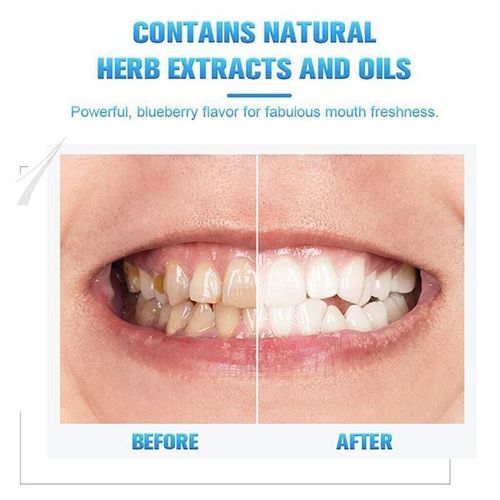 Teeth Whitening Pen