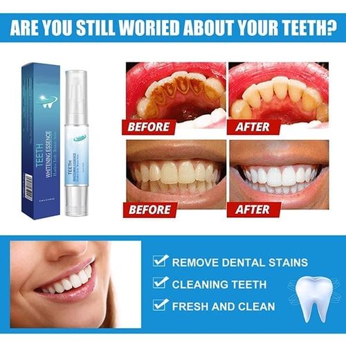 Teeth Whitening Pen