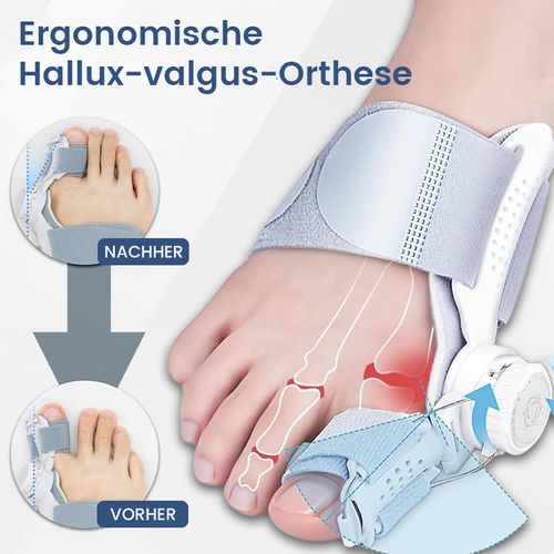 Ergonomic Hallux Valgus Orthosis