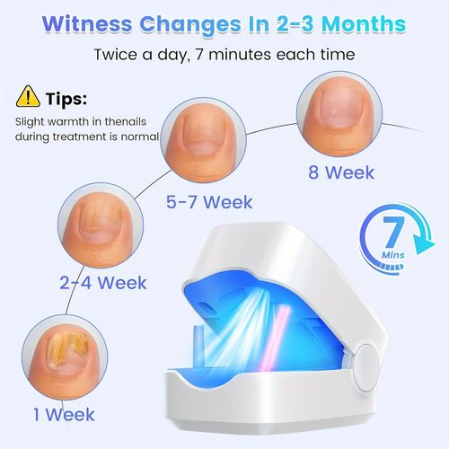 Nail treatment device