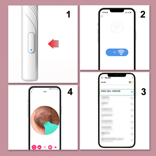 Earwax Removal Device with HD Camera