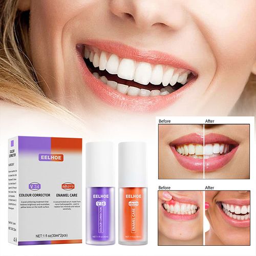 🔥SISTE DAG 49% AVSLAG🔥V34 Tannfargekorrigerende serum