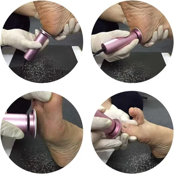 🔥🚀50% off for a limited time🚀Cash on delivery in Ghana🔥Electric Foot Callus Remover