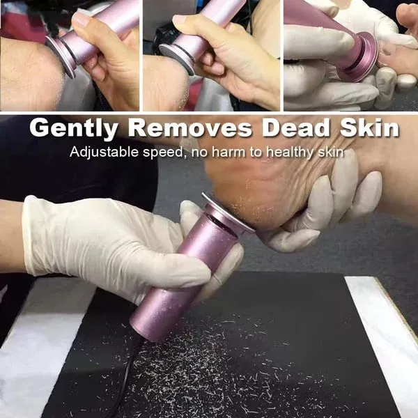 🔥🚀50% off for a limited time🚀Cash on delivery in Ghana🔥Electric Foot Callus Remover