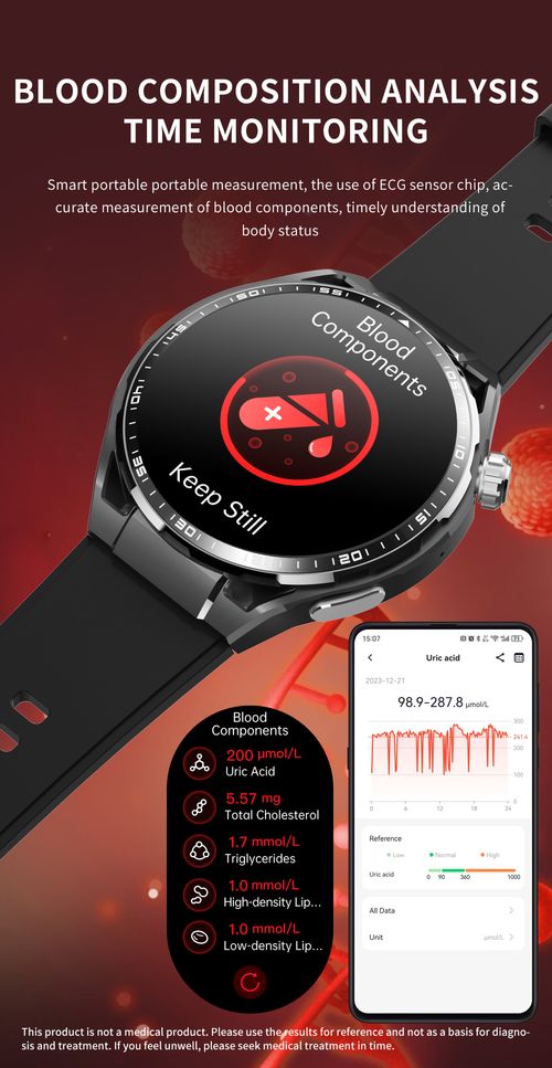 Smart watch for heart rate, blood pressure monitoring and exercise detection