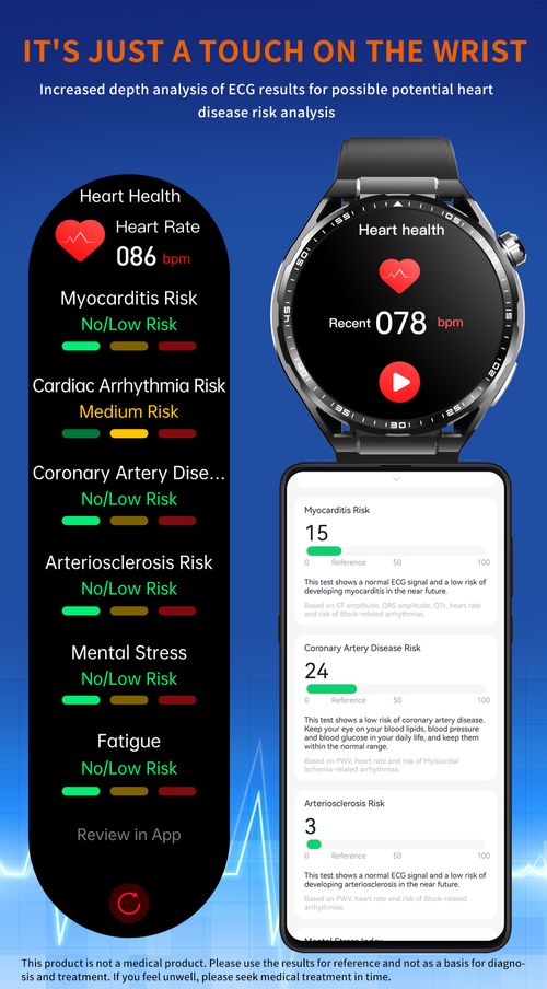 Smart watch for heart rate, blood pressure monitoring and exercise detection