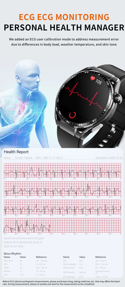 Smart watch for heart rate, blood pressure monitoring and exercise detection