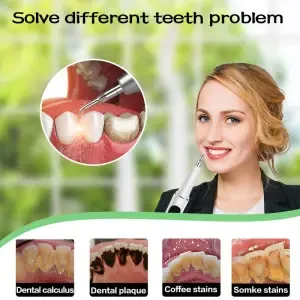 Removedor oral de placa tártaro, kit de limpeza dentária removedor de cálculo com luz LED e 5 modos ajustáveis recarregáveis