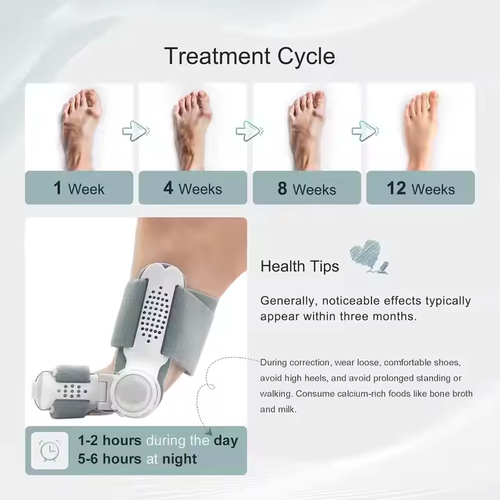 bunion corrector