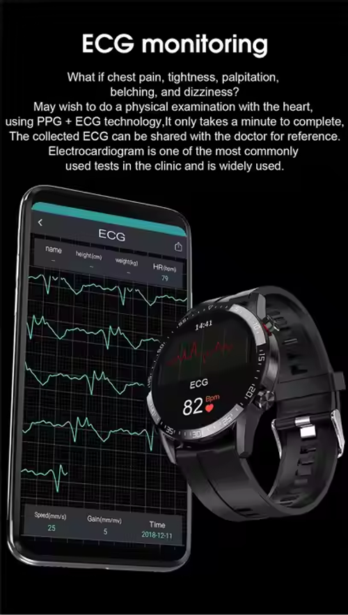 smartwatch phone
