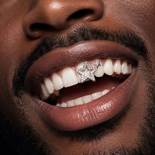 copper inlaid zircon dental braces.