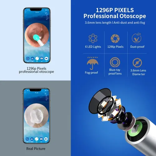 (🔥Last Day Promotion- SAVE 48% OFF)1080P Ear Wax Removal Camera