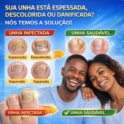 Patches para Unhas Fúngicas ELAIMEI | Tratamento Noturno de 8h | Entrega no Mesmo Dia em Luanda