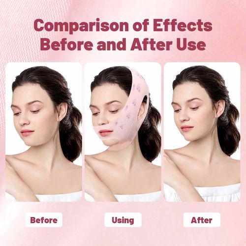 V Line Face Lifting Strap, Chin Strap for Sleeping, Double Chin Reducer for Women, Jaw Line Sculptor Eliminator, Mask Shaper for Jawline, Neck Lift Jaw Tightening Exerciser, Face Lift Tape Remover