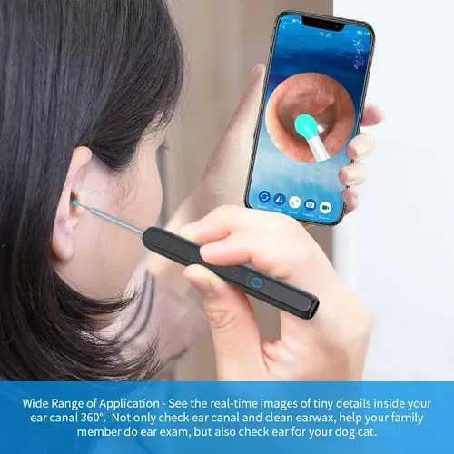 (🔥Last Day Promotion- SAVE 48% OFF)1080P Ear Wax Removal Camera + 8-piece tool set