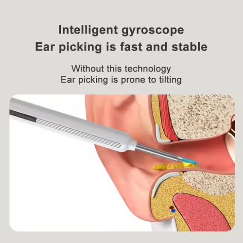 Visual Ear Cleaning Spoon - Smart WIFI-connected Ear Cleaning Device - Ideal Household Ear Cleaning Tool - Ear Cleaning Spoon