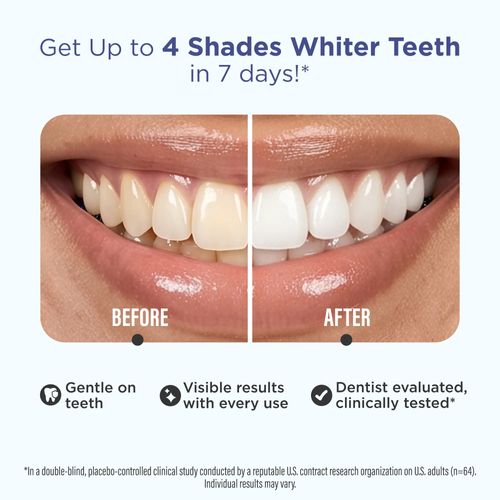 Whitening Strips