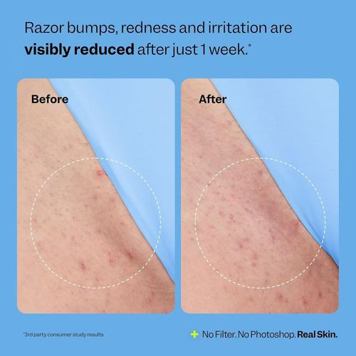 Skin care lotion