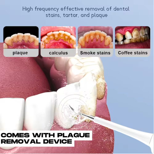 Electric Teeth Cleaner Set