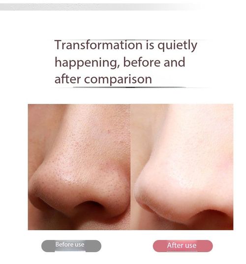 3-in-1 Electric Facial Cleansing Brush Lifting Moisturizing Beauty Device for Kenya Home Skincare