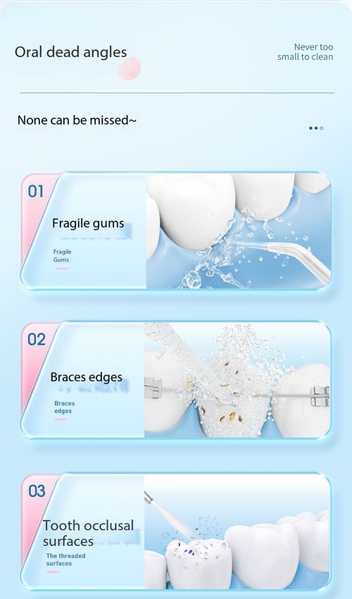 Portable Electric Water Flosser Dental Irrigator with 180ml Tank IPX7 Waterproof