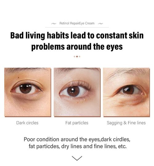 Retinol Repair Eye Cream Anti-Wrinkle Dark Circle Remover Firming Moisturizing