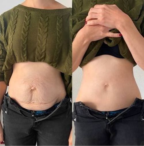 VenomCare™ Target Pain. Restore Movement.