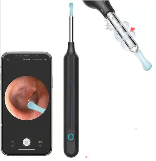 1080P Ear Wax Removal Camera