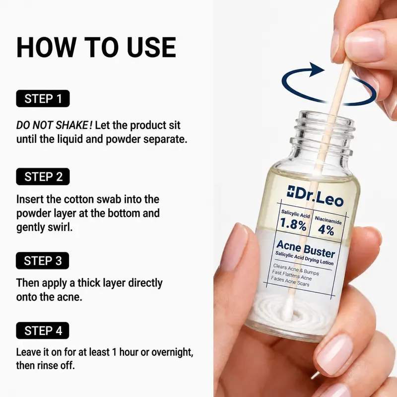 Dr.Leo Drying Lotion | Pimple Treatment & Body Acne Treatment | Visibly Shrinks Pimples in 24 Hours & Helps Fade Acne Marks in 7 Days | With 1.8% Encapsulated Salicylic Acid, 4% Niacinamide & 10% Sulfur (20ml)