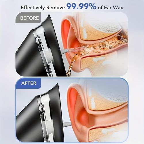 Ear Cleaner