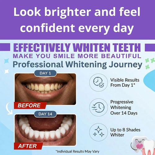 Say hello to the BRAND NEW  BrightSmile Purple Whitening Strips