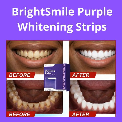 Say hello to the BRAND NEW  BrightSmile Purple Whitening Strips