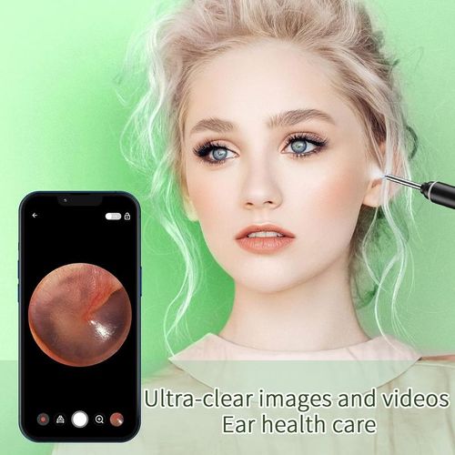 Ear Wax Removal Tool With Camera, 1 Set Portable Type-C Rechargeable Ear Cleaner, Waterproof Endoscope Ear Cleaning Tool, Earwax Removal Tool, Earwax Removal Kit