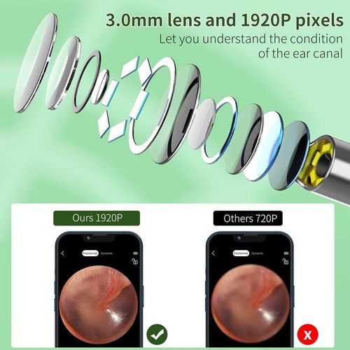 Ear Wax Removal Tool With Camera, 1 Set Portable Type-C Rechargeable Ear Cleaner, Waterproof Endoscope Ear Cleaning Tool, Earwax Removal Tool, Earwax Removal Kit