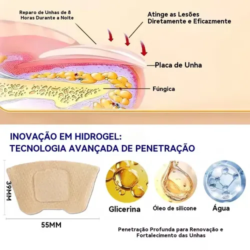 🚫🦠 Adesivos para Tratamento de Unhas com Fungos 🚫🦠 —— Diga Adeus às Unhas com Fungos, Recupere Unhas Saudáveis e Fortes!
