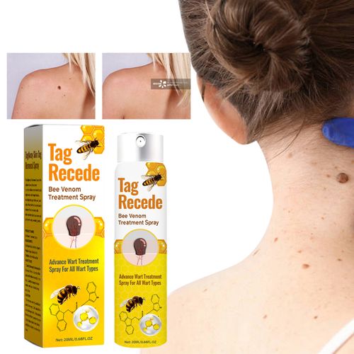BEEVENOM Skin Wart Care Spray | Daily Skin Care Formula