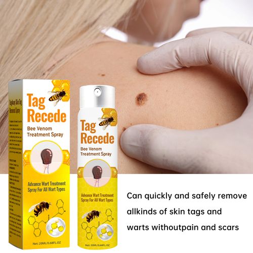 BEEVENOM Skin Wart Care Spray | Daily Skin Care Formula