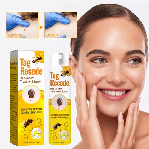 BEEVENOM Skin Wart Care Spray | Daily Skin Care Formula