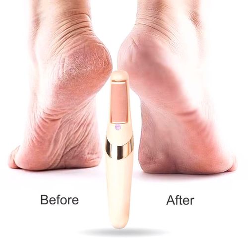 Electric Callus Remover | Rechargeable & Waterproof Pedicure Tool